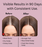 VIAARO Electric Head Scalp Massager Comb with Oil Applicator | 4D Rotating Massage Brush for Scalp & Hair Care | Rechargeable Cordless Scalp Massager | Oil Dispensing Hair Massage Comb for Men & Women