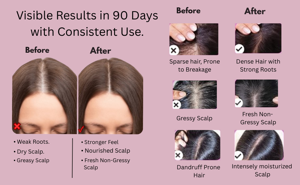 VIAARO Electric Head Scalp Massager Comb with Oil Applicator | 4D Rotating Massage Brush for Scalp & Hair Care | Rechargeable Cordless Scalp Massager | Oil Dispensing Hair Massage Comb for Men & Women